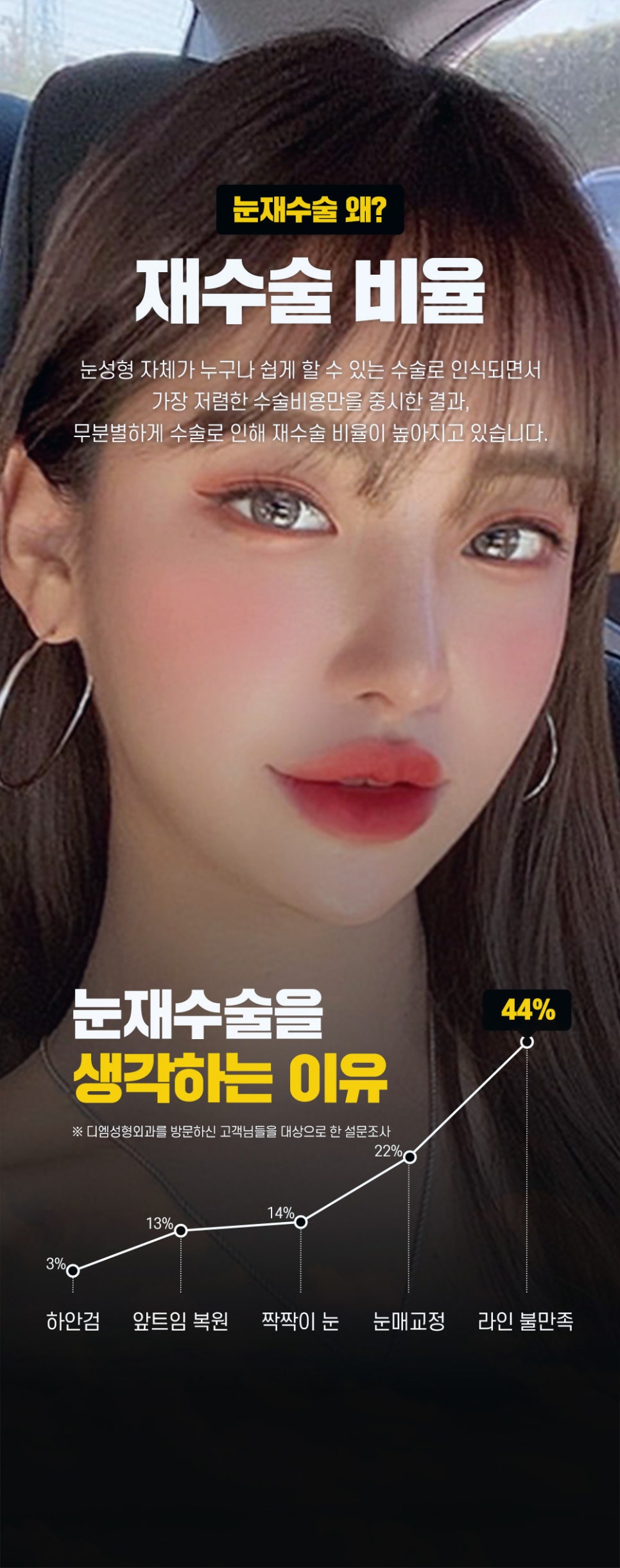 눈재수술, 쌍꺼풀이 풀려 비대칭 눈매가 되었다면? 관련 이미지 2