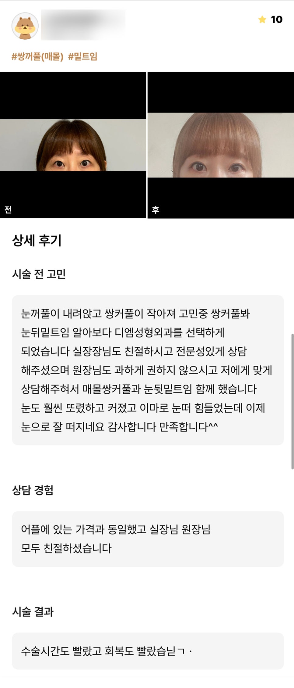 눈성형 후기."눈이 훨씬 또렷해지고 커졌어요!" 관련 이미지 1