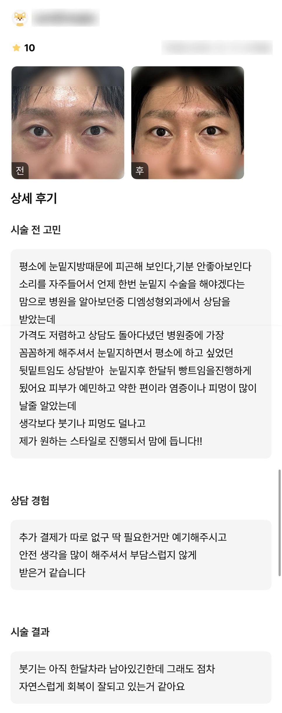 눈성형 후기."제가 원하는 스타일로 진행돼서 맘에 들어요!" 관련 이미지 1