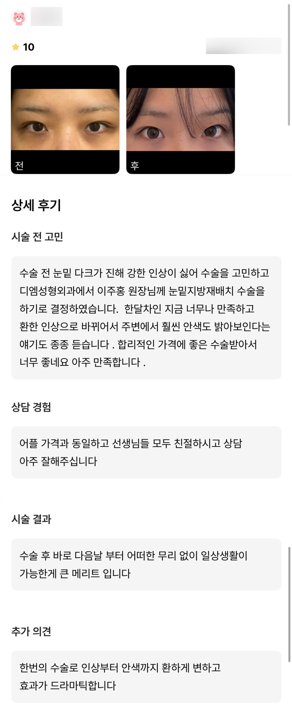 눈밑지방재배치 후기."한번의 수술로 인상부터 안색까지 환하게 변하고 효과가 드라마틱해요!" 관련 이미지 1