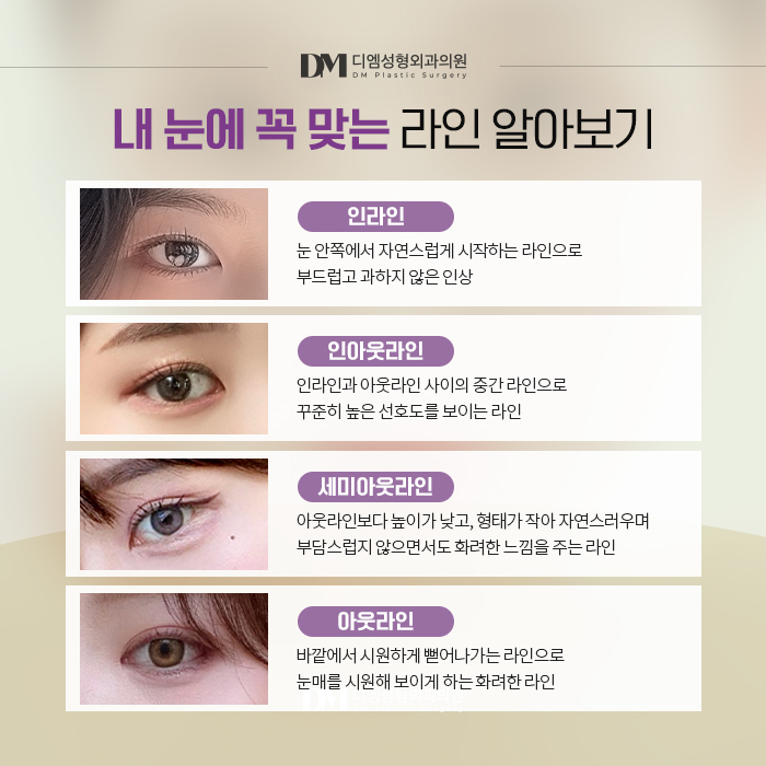 쌍꺼풀수술, 내 눈매에 맞는 자연스러운 라인으로 관련 이미지 5