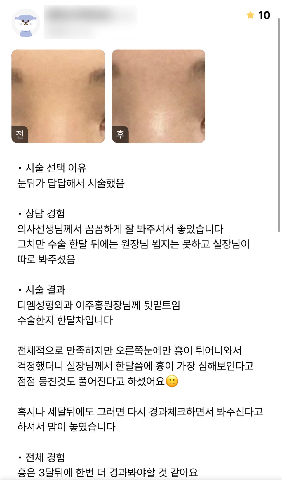 Canthoplasty Review: “Overall, I’m satisfied, and I was glad they also checked the areas I was worried about!” image 1