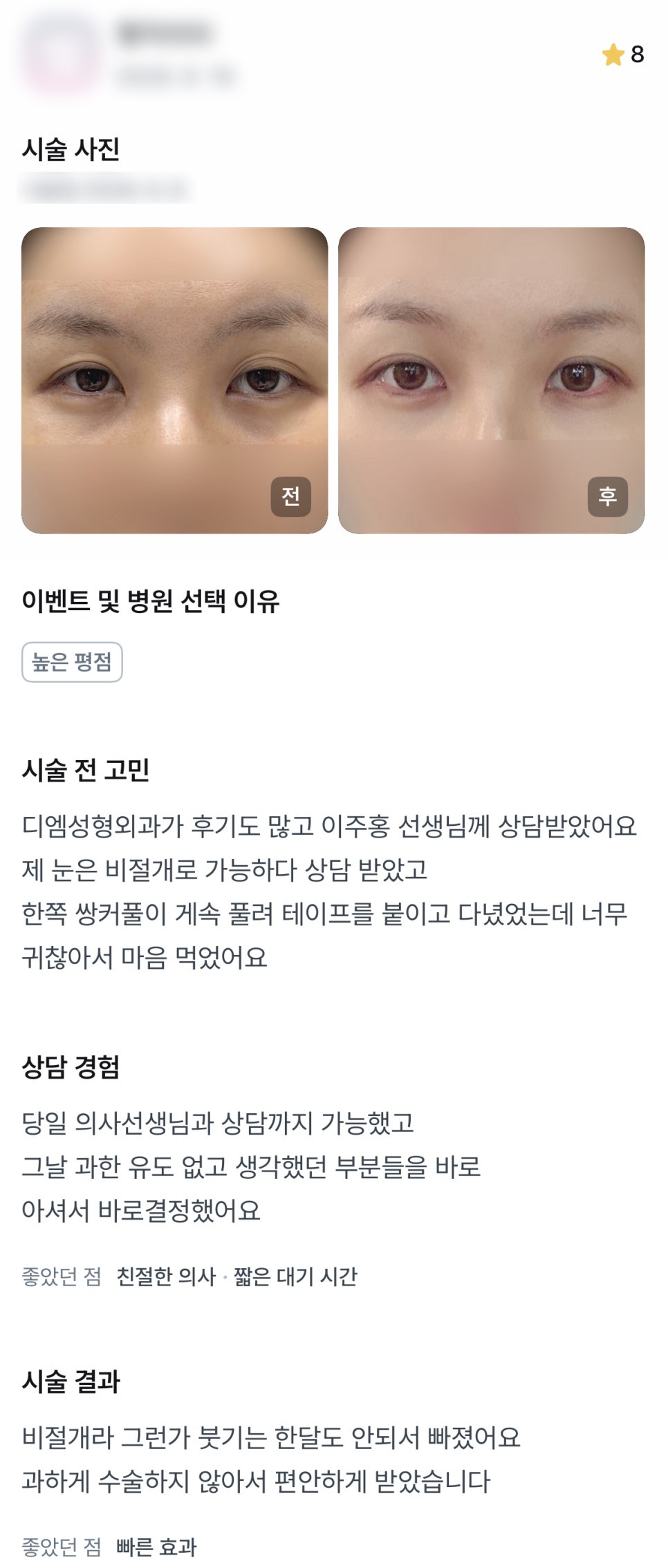 디엠 눈매교정/눈성형 후기, “과한 유도 없어서 편안하게 받았습니다!” 관련 이미지 1