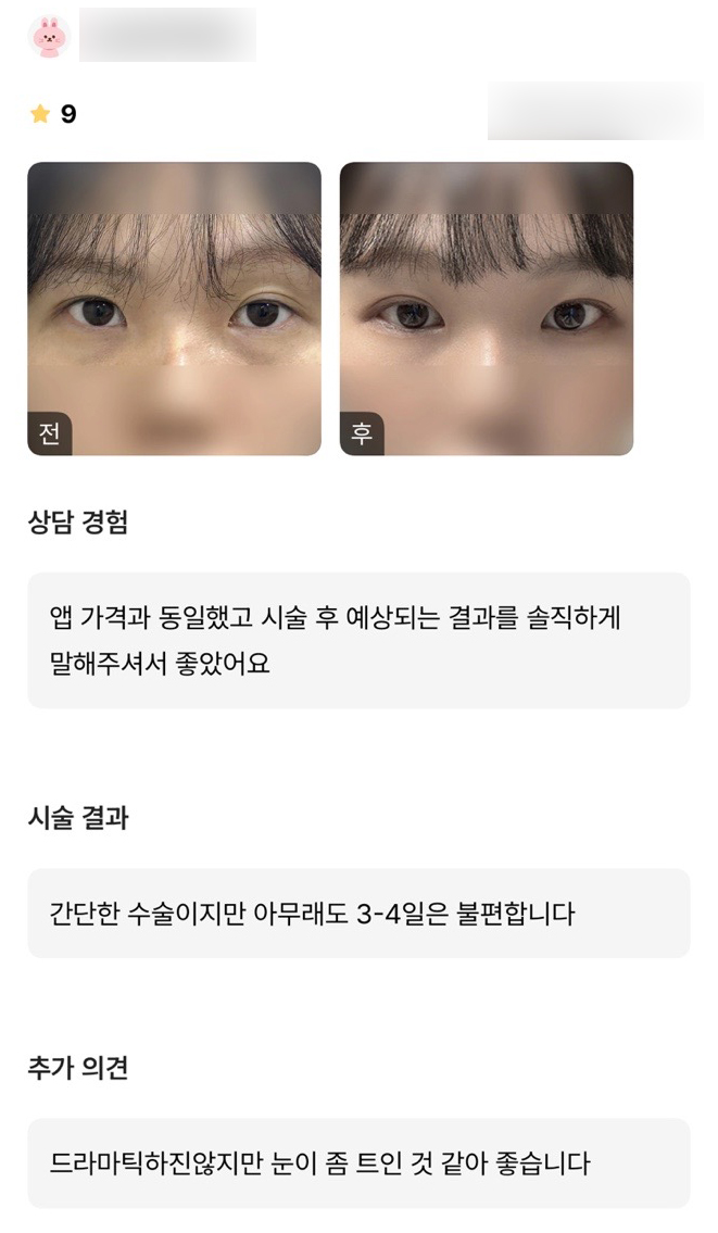 디엠 빵트임 수술후기, &ldquo;눈이 좀 트인 것 같아 좋습니다!&rdquo; 관련 이미지 1