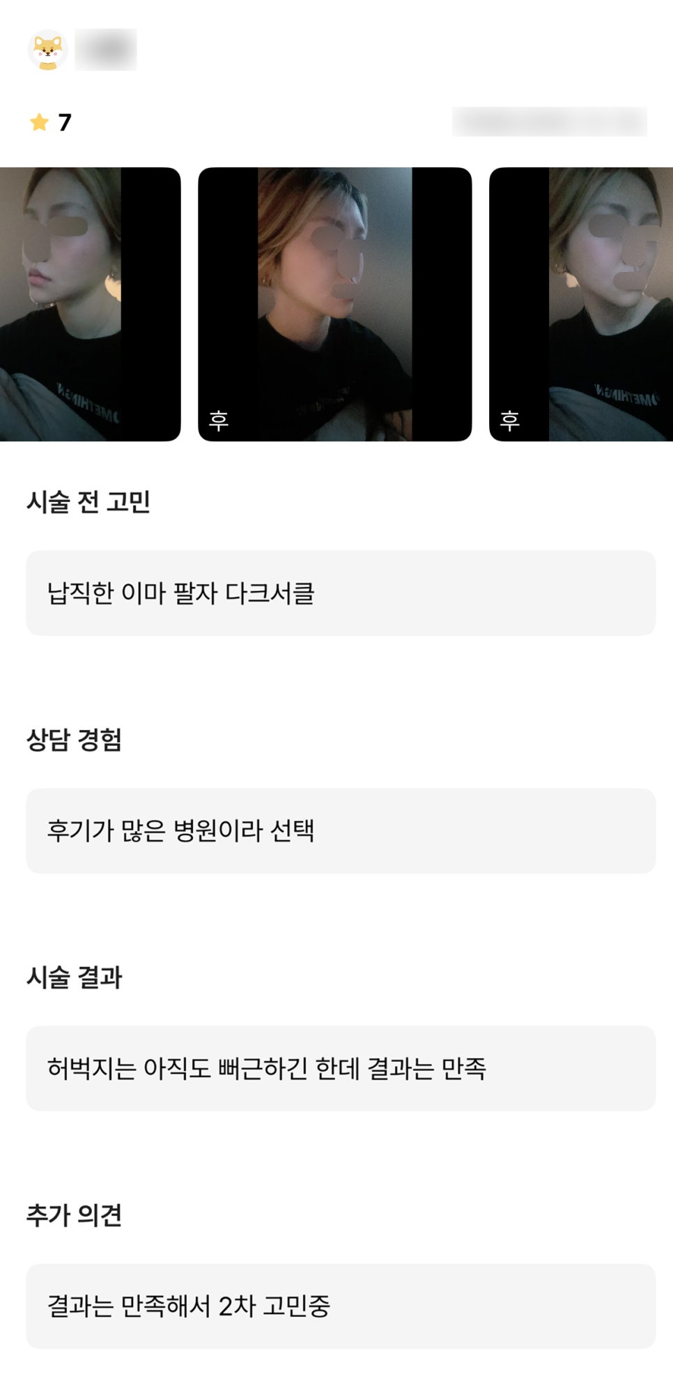얼굴지방이식 후기."만족스러워서 2차도 계획중이에요!" 관련 이미지 1