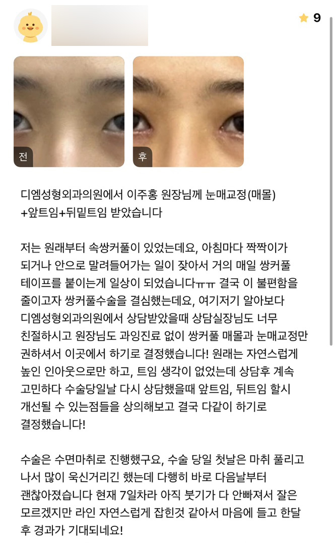눈성형 후기."자연스럽게 잡혀 마음에들어요! 한달 후가 기대돼요!" 관련 이미지 1