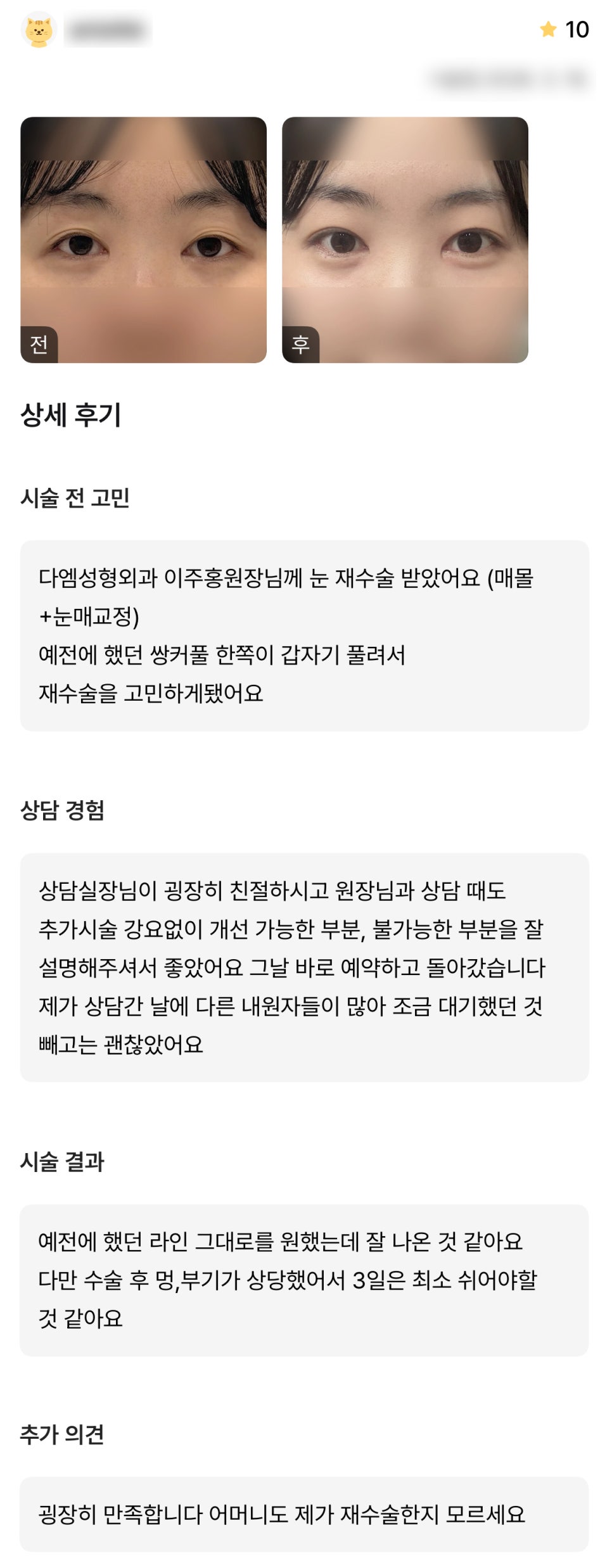 디엠 눈재수술/눈매교정 수술후기, &ldquo;예전 라인 그대로 원했는데 잘 나온 것 같아요!&rdquo; 관련 이미지 1