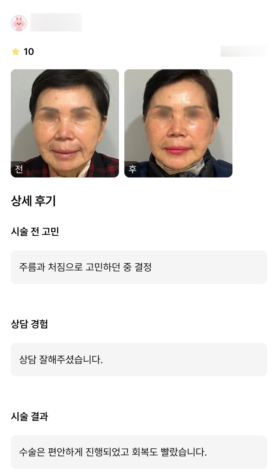 Facelift Revision Surgery Review. "I’m happy that the recovery is fast too!" image 1