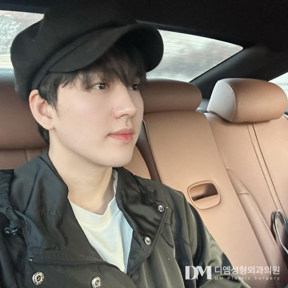 화살코성형, 어느각도에서도 예쁜 코로 변신하기 관련 이미지 1
