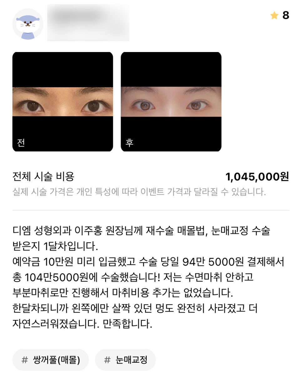 Blepharoplasty Review. "Now that it’s been a month, it looks even more natural, so I’m satisfied!" image 1