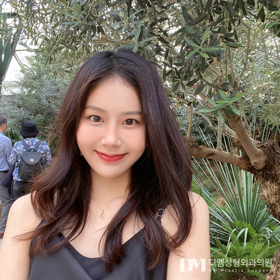 뒤밑트임, 사납거나 답답한 눈매 고민 해결 관련 이미지 1