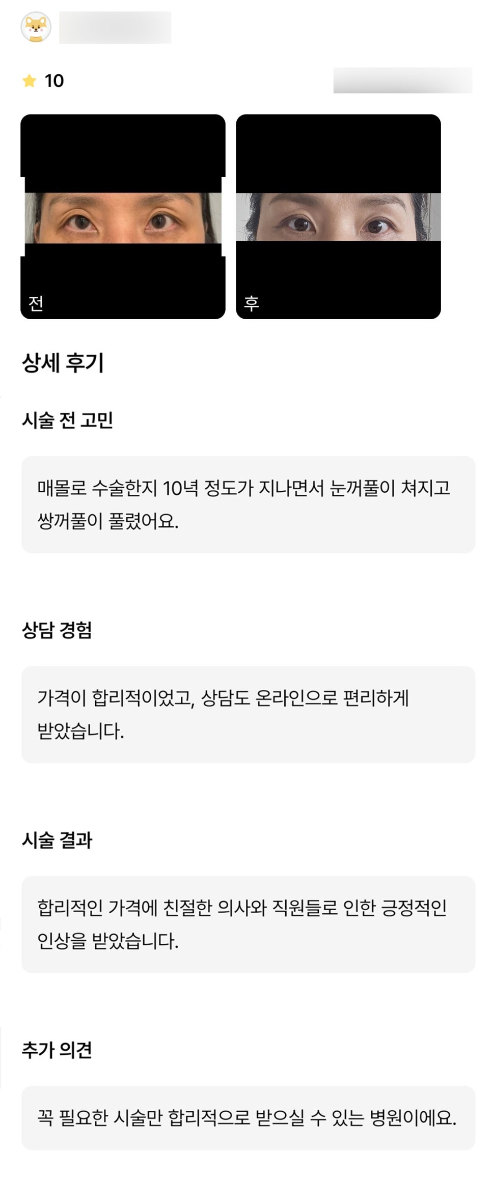 눈재수술 후기."꼭 필요한 시술만 합리적으로 받을 수 있어 좋았어요!" 관련 이미지 1