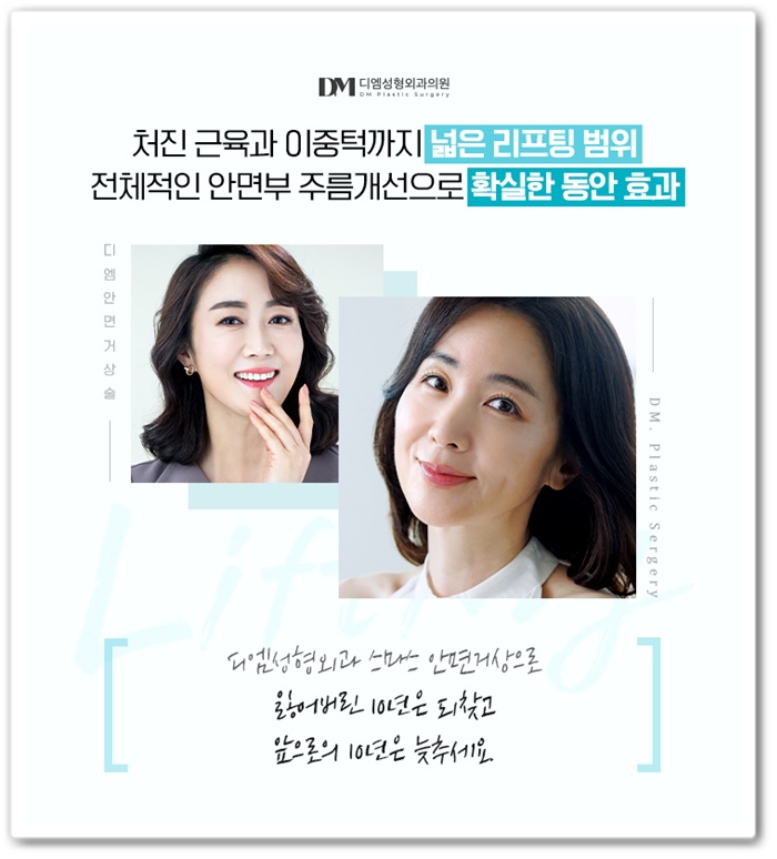 안면거상, 개인별 맞춤형 플랜으로 더욱 높아진 만족도! 관련 이미지 16