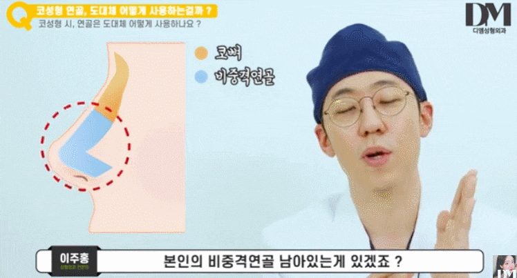 낮은코성형, 쉐딩 메이크업 탈출하자! 관련 이미지 7
