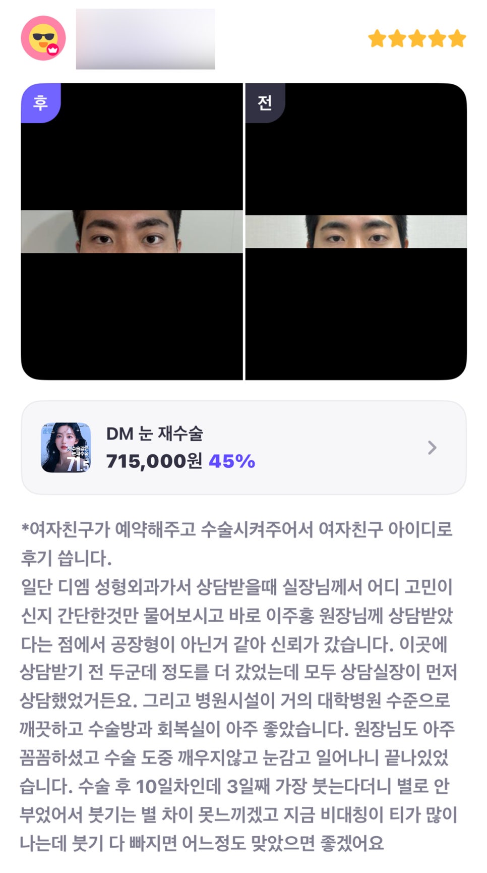 Revision Eyelid Surgery Review. "The director was thorough and it seemed like it wasn’t a factory-style clinic, so I felt confident!" image 1