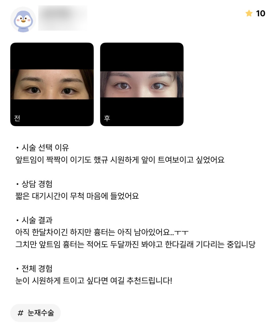 눈재수술 후기."눈이 시원하게 트이고 싶다면 여길 추천 드립니다 !" 관련 이미지 1