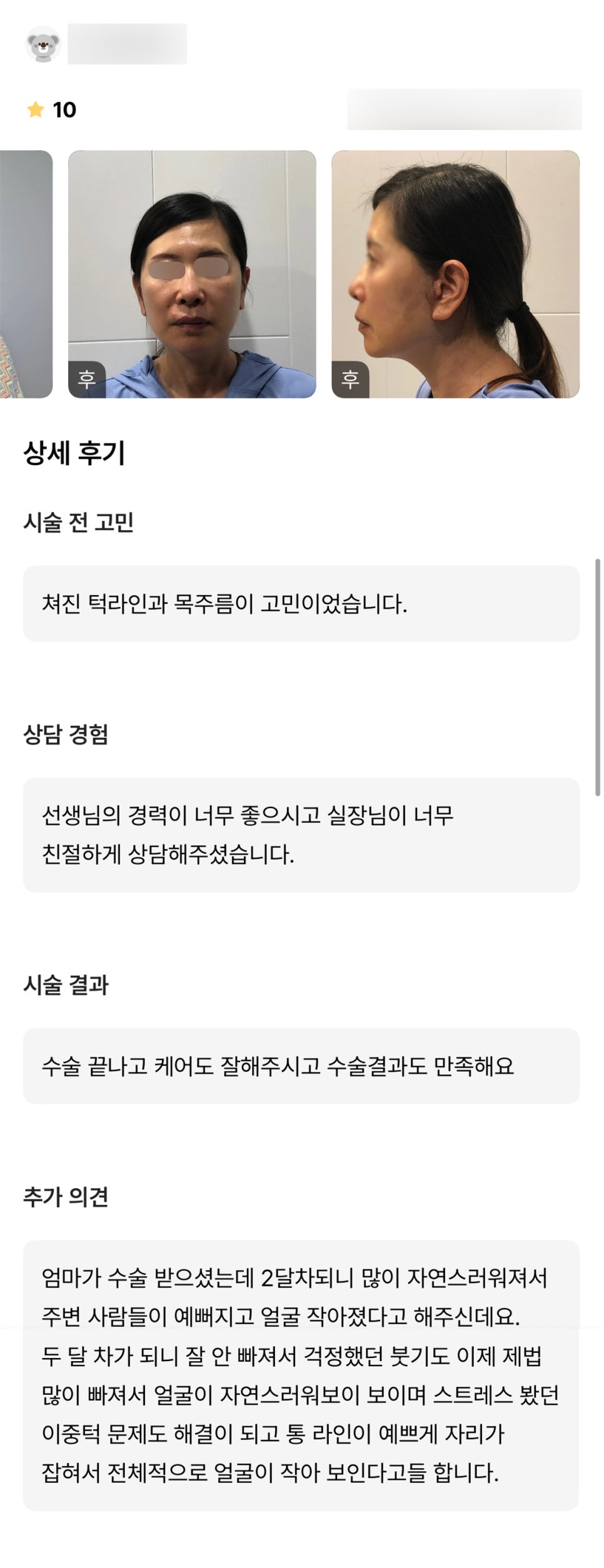 안면거상 후기."전체적으로 얼굴이 작아보인대요!" 관련 이미지 1