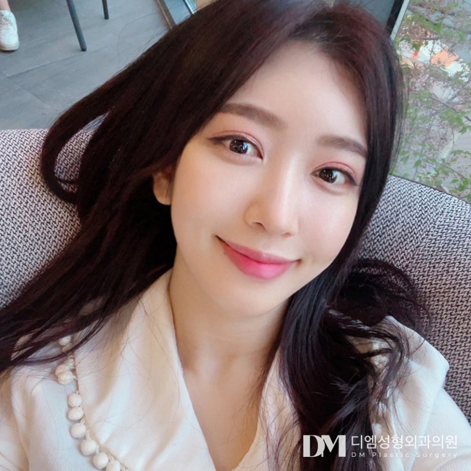 흉터 걱정 줄인 3040 리프팅, 디엠 반거상 수술방법은? 관련 이미지 2