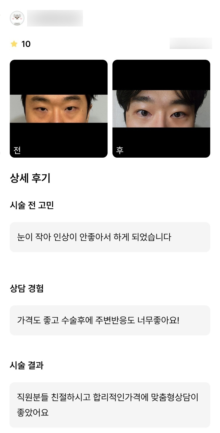 눈성형 후기."합리적인 가격에 맞춤형 상담이 좋았어요!" 관련 이미지 1