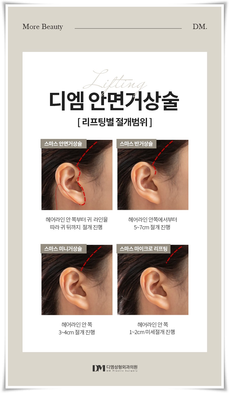 안면거상, 탄력을 잃은 피부가 고민이라면 관련 이미지 12