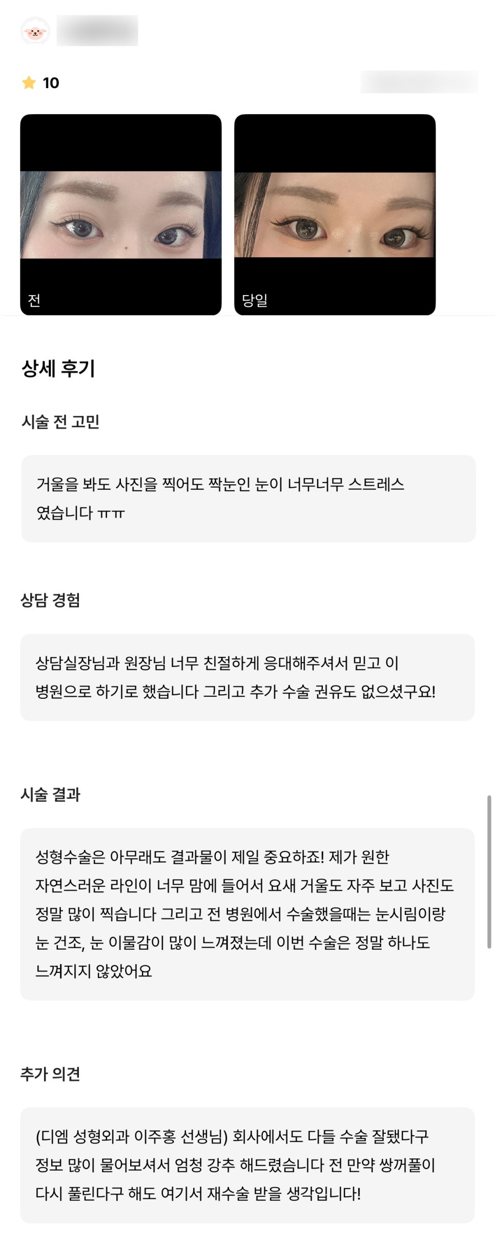 눈재수술 후기."제가 원한 자연스러운 라인이 너무 맘에들어요!!" 관련 이미지 1