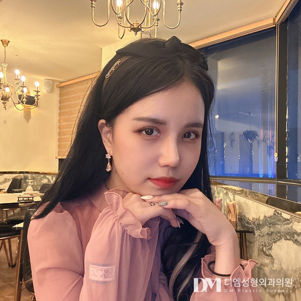 코끝성형, 세련된 이미지를 주고싶다면? 관련 이미지 12