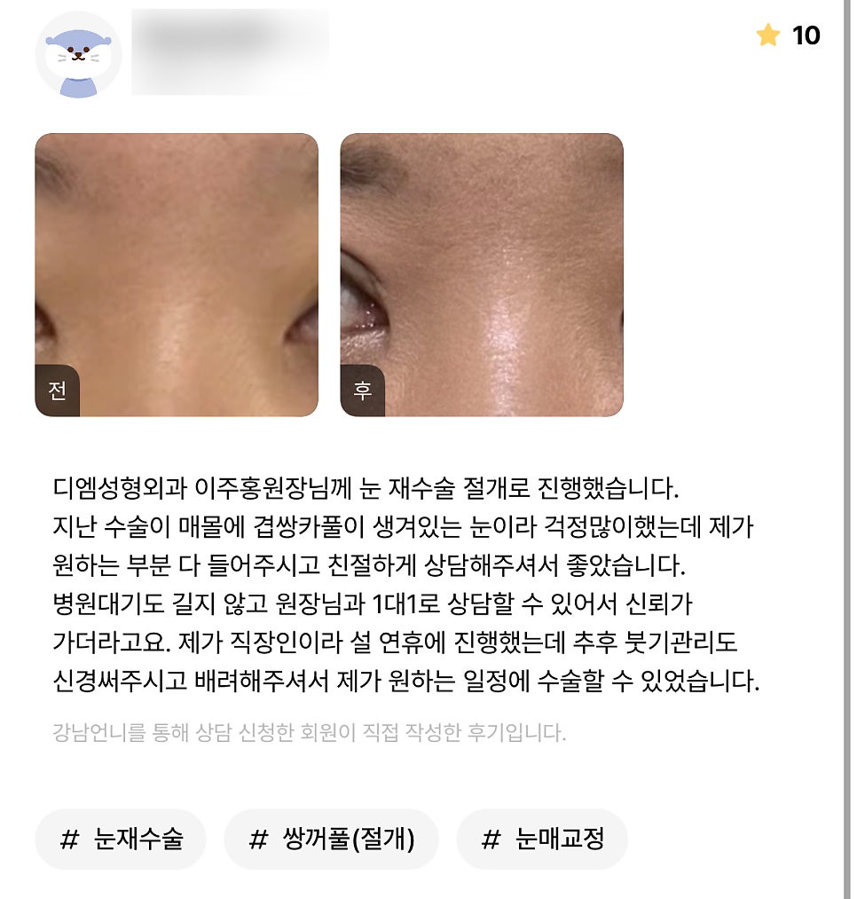 눈성형 후기."원장님과 1대 1로 상담할 수 있어서 신뢰가 가더라고요!" 관련 이미지 1