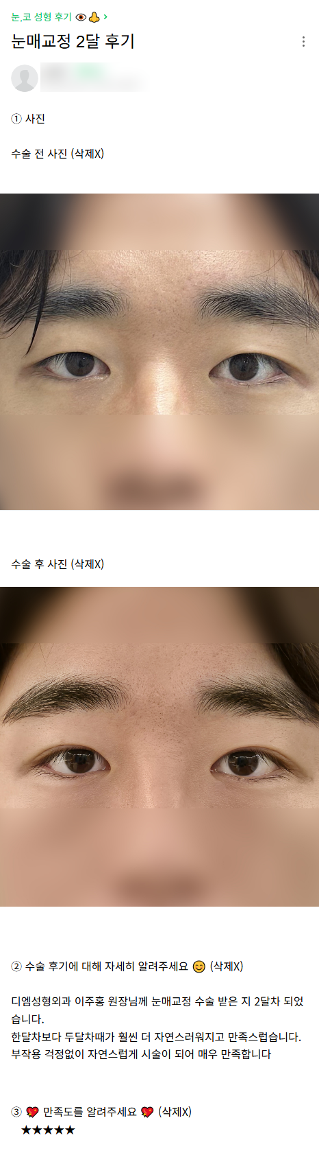 디엠 남자눈매교정 후기, “자연스러워서 매우 만족합니다!” 관련 이미지 1