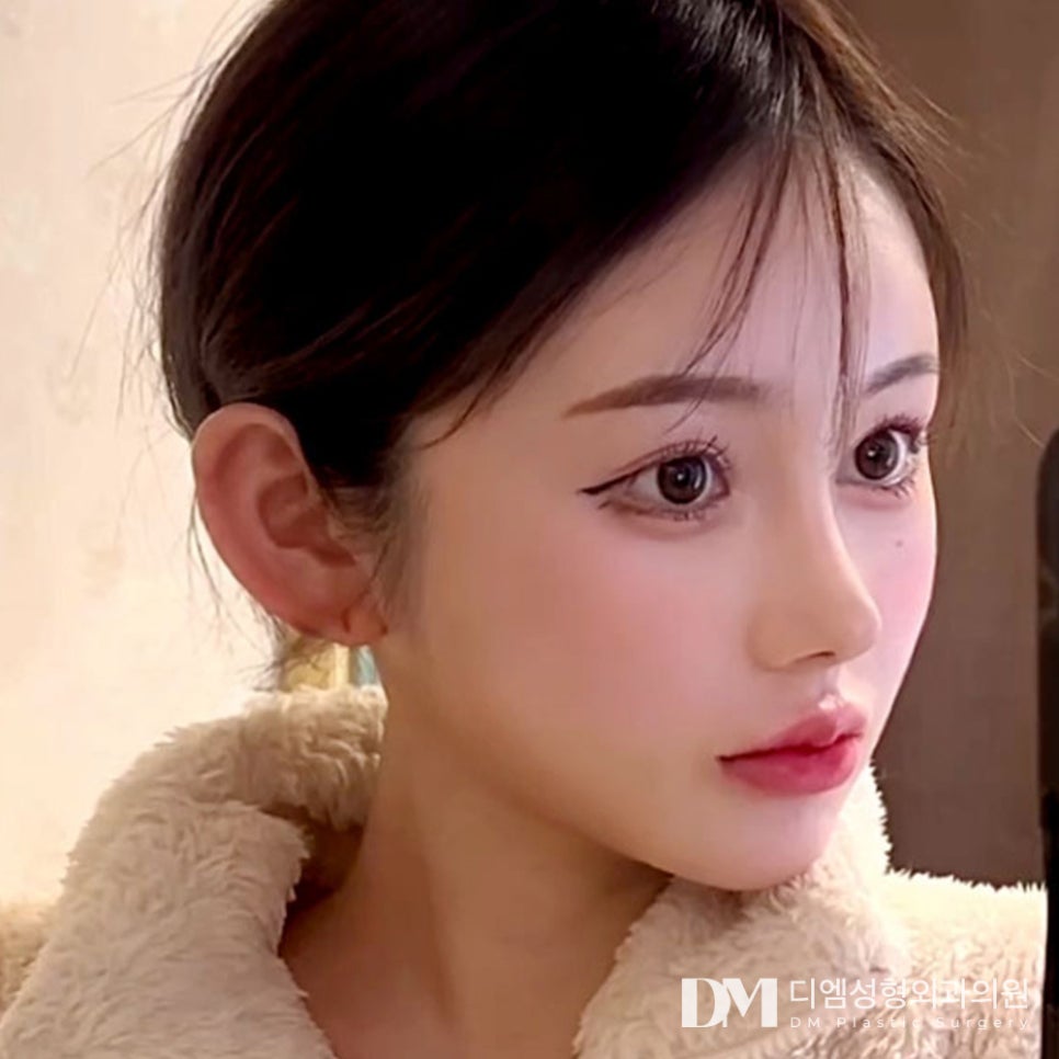 울퉁불퉁해 자신없는 옆모습, 이제 탈출하자 ! 관련 이미지 10