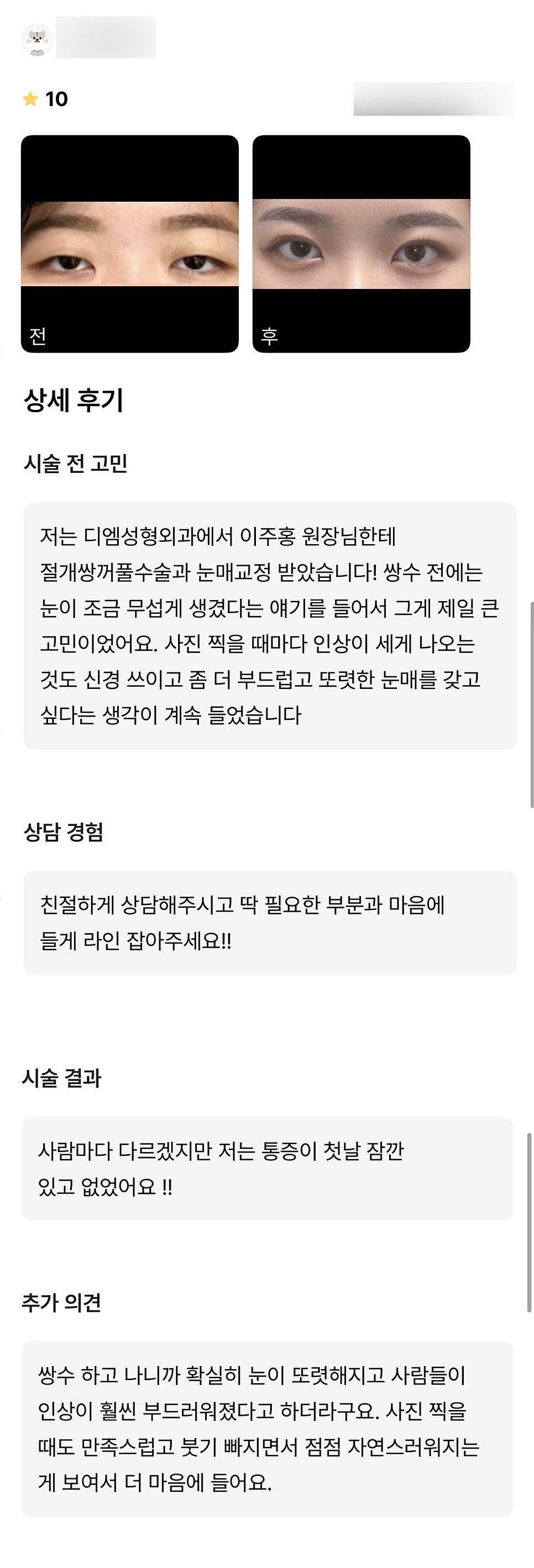 눈성형 후기."확실히 눈이 또렷해지고 인상이 부드러워졌대요!" 관련 이미지 1