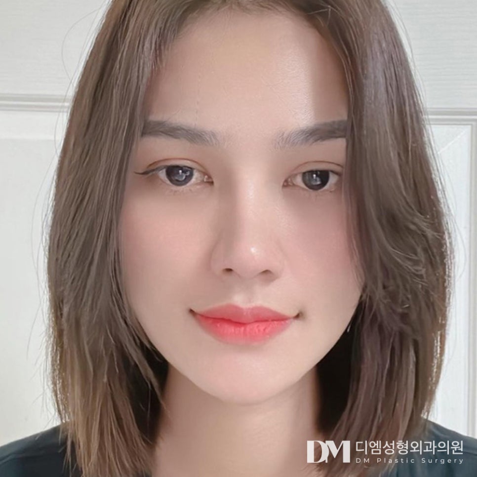 어둡고 울퉁불퉁한 눈밑으로 늘 피곤해보인다는 소리를 듣는다면? 관련 이미지 1