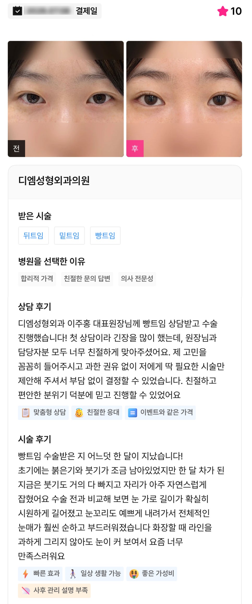 디엠 뒤밑트임/트임성형 후기, “전체적인 눈매가 훨씬 순하고 부드러워졌어요!” 관련 이미지 1