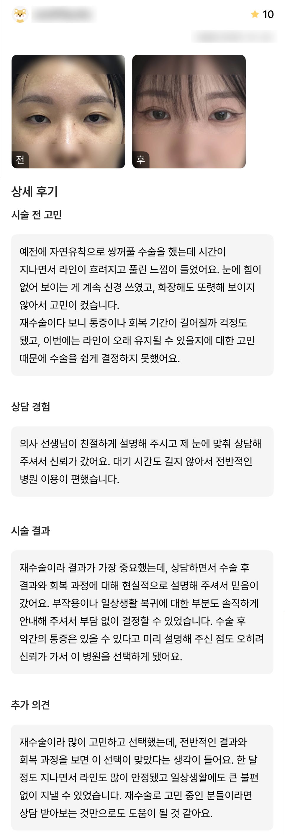 디엠 눈재수술 후기, &ldquo;제 눈에 맞춰 상담해주셔서 신뢰가 갔어요!&rdquo; 관련 이미지 1