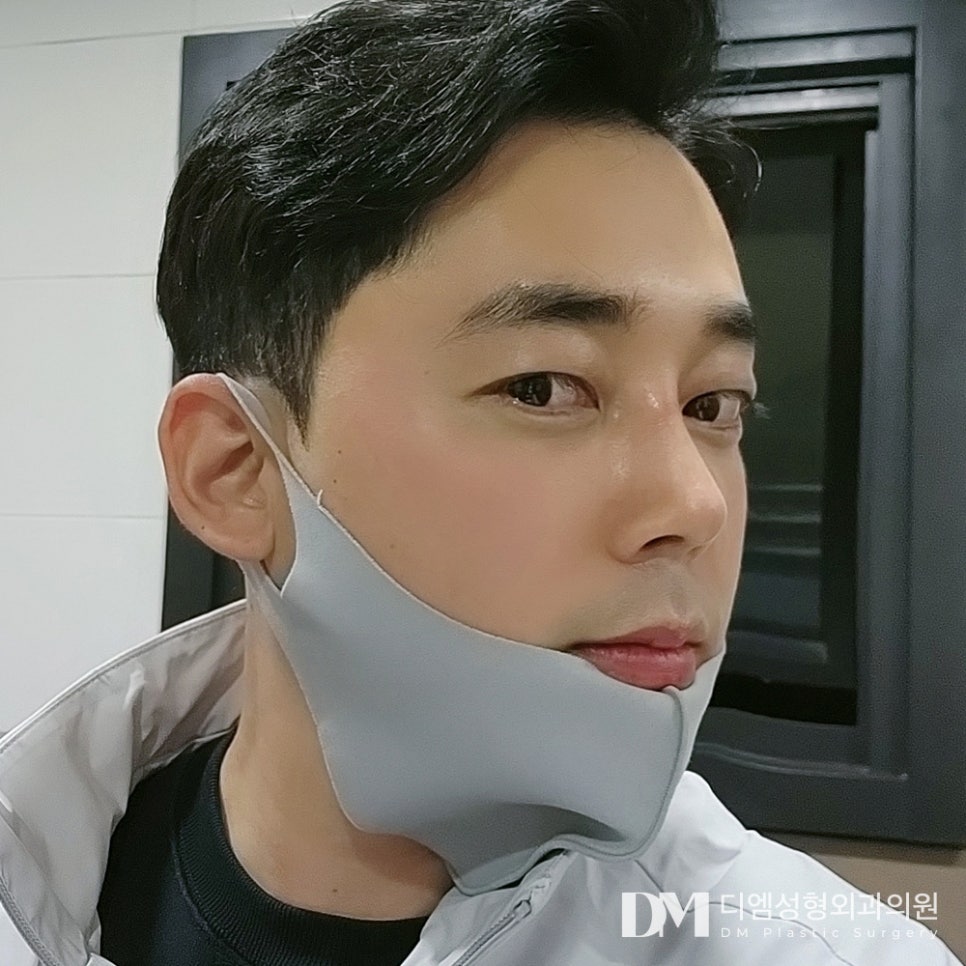 매부리코, 옆모습이 스트레스라면? 관련 이미지 10