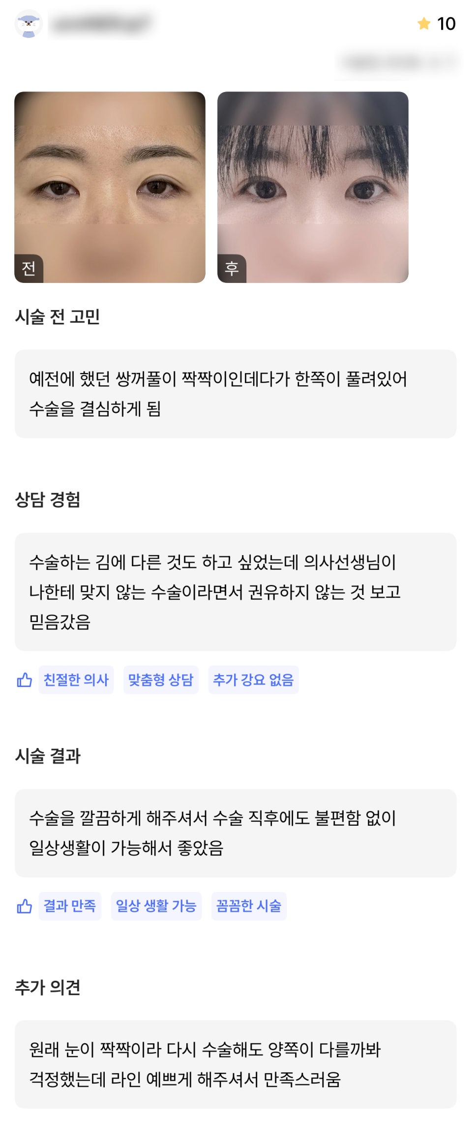 DM Revision Eyelid Surgery/Eye Contouring Correction Review, “I’m Satisfied Because You Created Such a Beautiful Line!” image 1