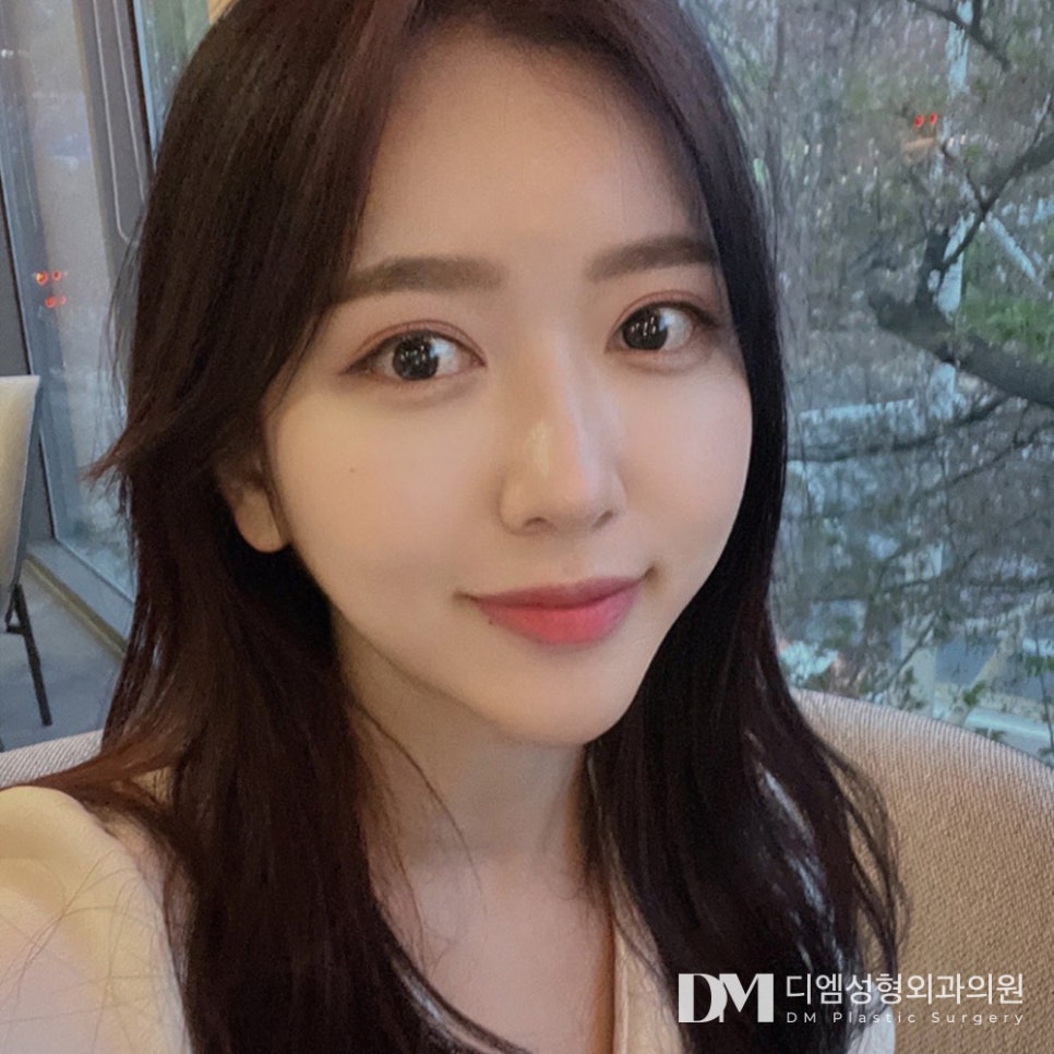 이마거상, 눈성형으로도 개선 안되는 처짐 개선 하기 관련 이미지 1