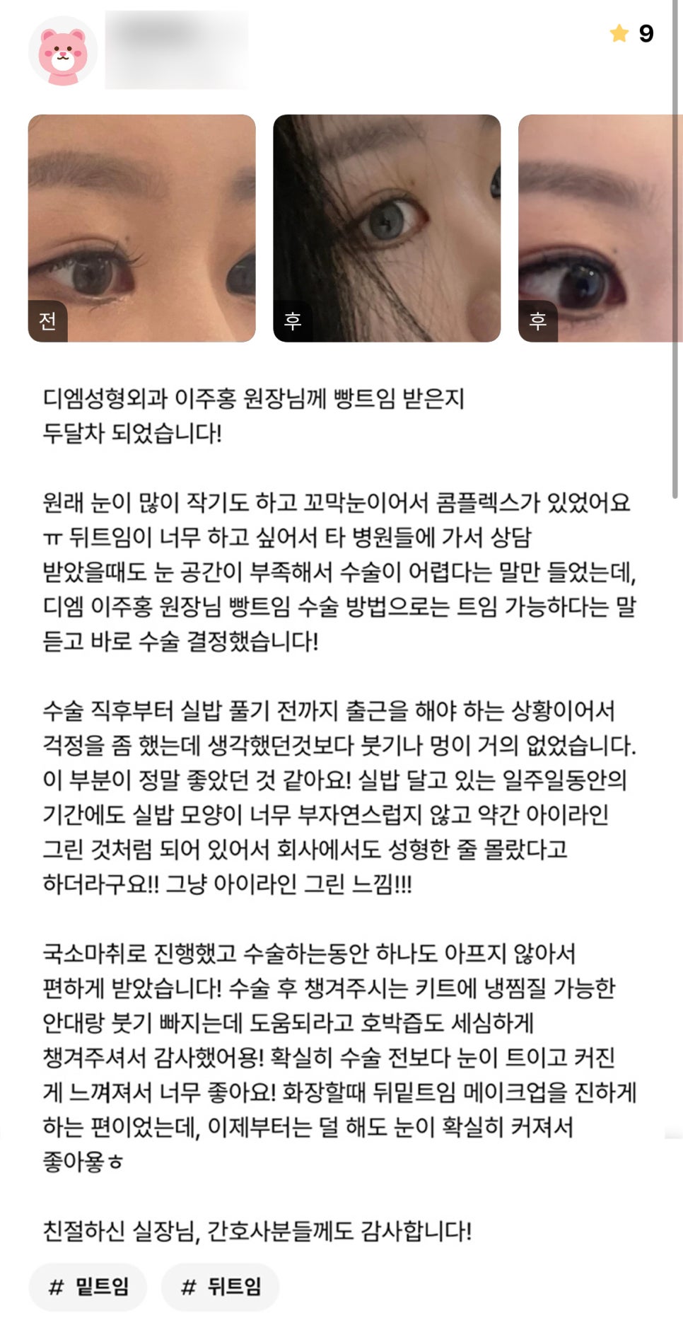 빵트임 후기."눈이 트이고 커진게 느껴져서 너무 좋아요!" 관련 이미지 1
