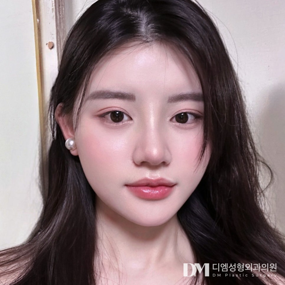 나에게 맞는 높이를 찾아주는 맞춤형 낮은코성형 관련 이미지 1