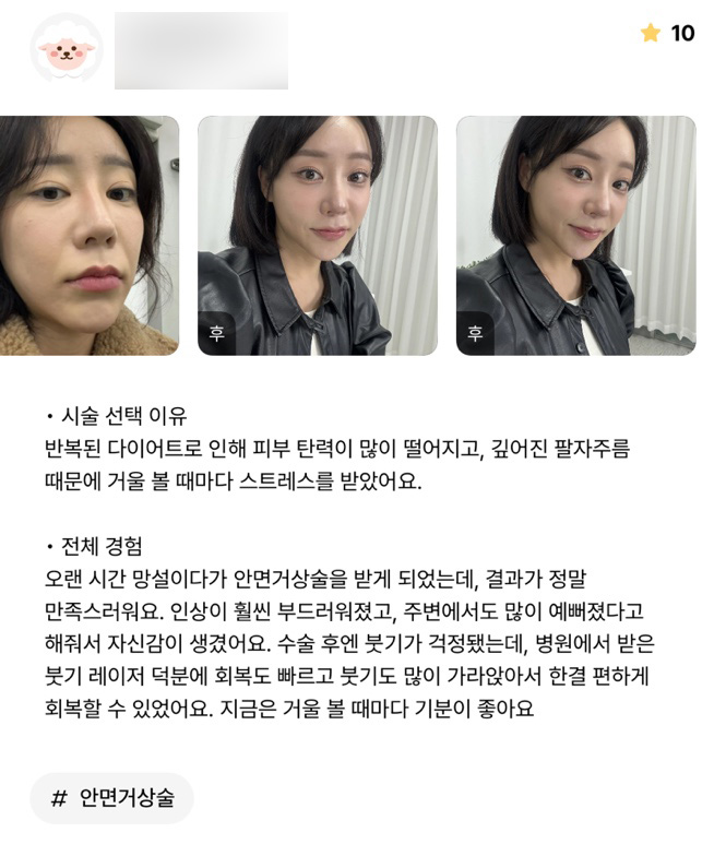 반거상 후기."지금은 거울 볼 때 마다 기분이 좋아요 !" 관련 이미지 1