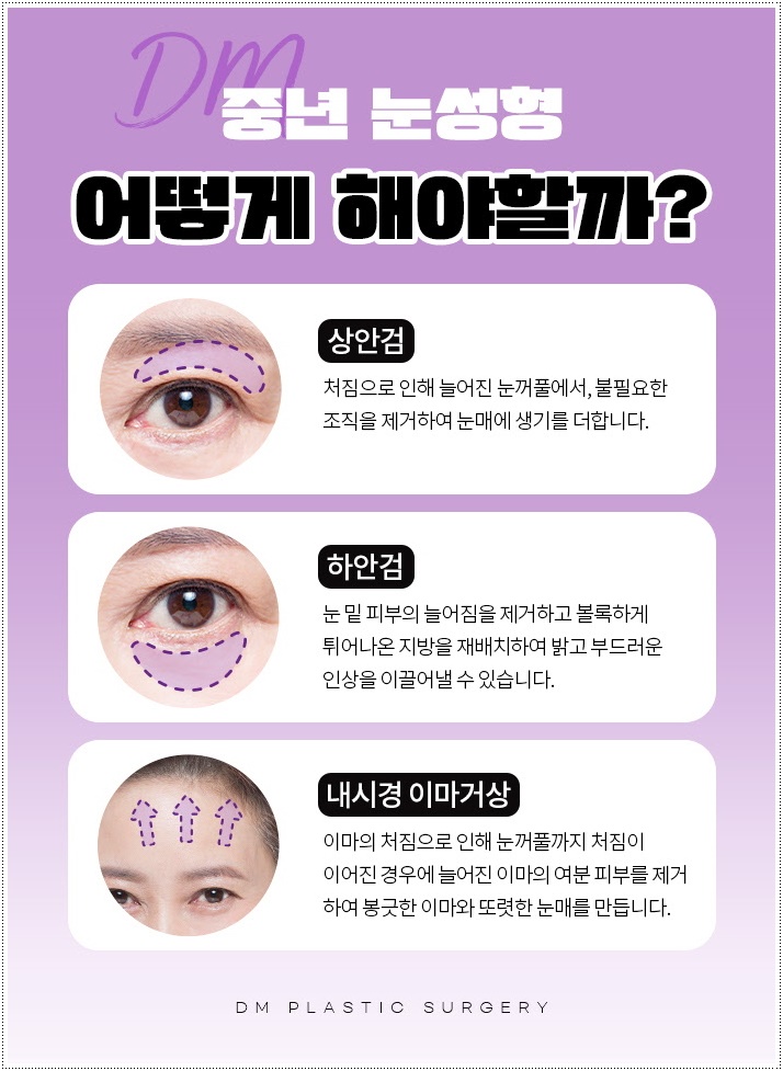 Improving Droopy Eyes with Upper Blepharoplasty image 2