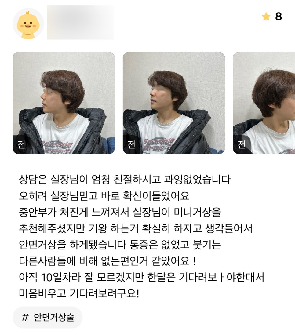 안면거상 후기."통증과 붓기가 없었어요!" 관련 이미지 1