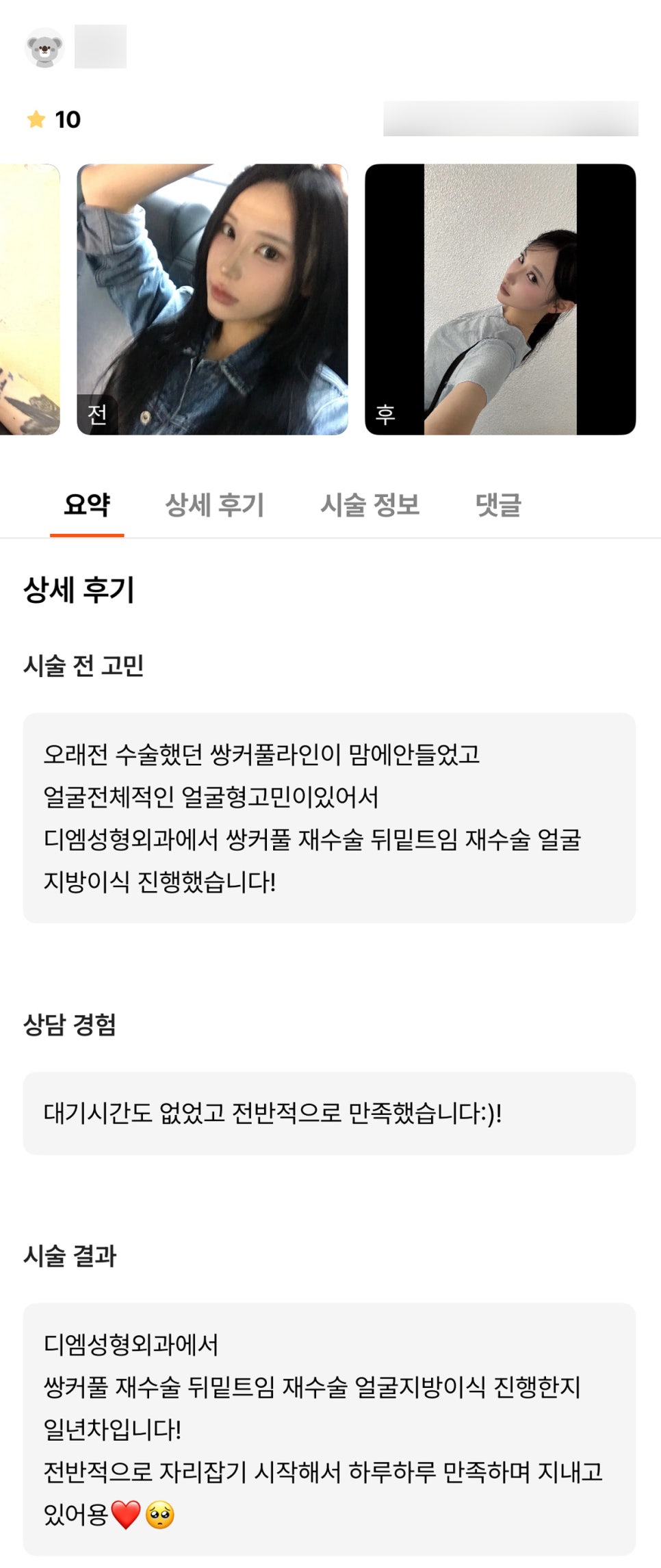 성형 후기."하루하루 만족하며 지내고 있어요!" 관련 이미지 1