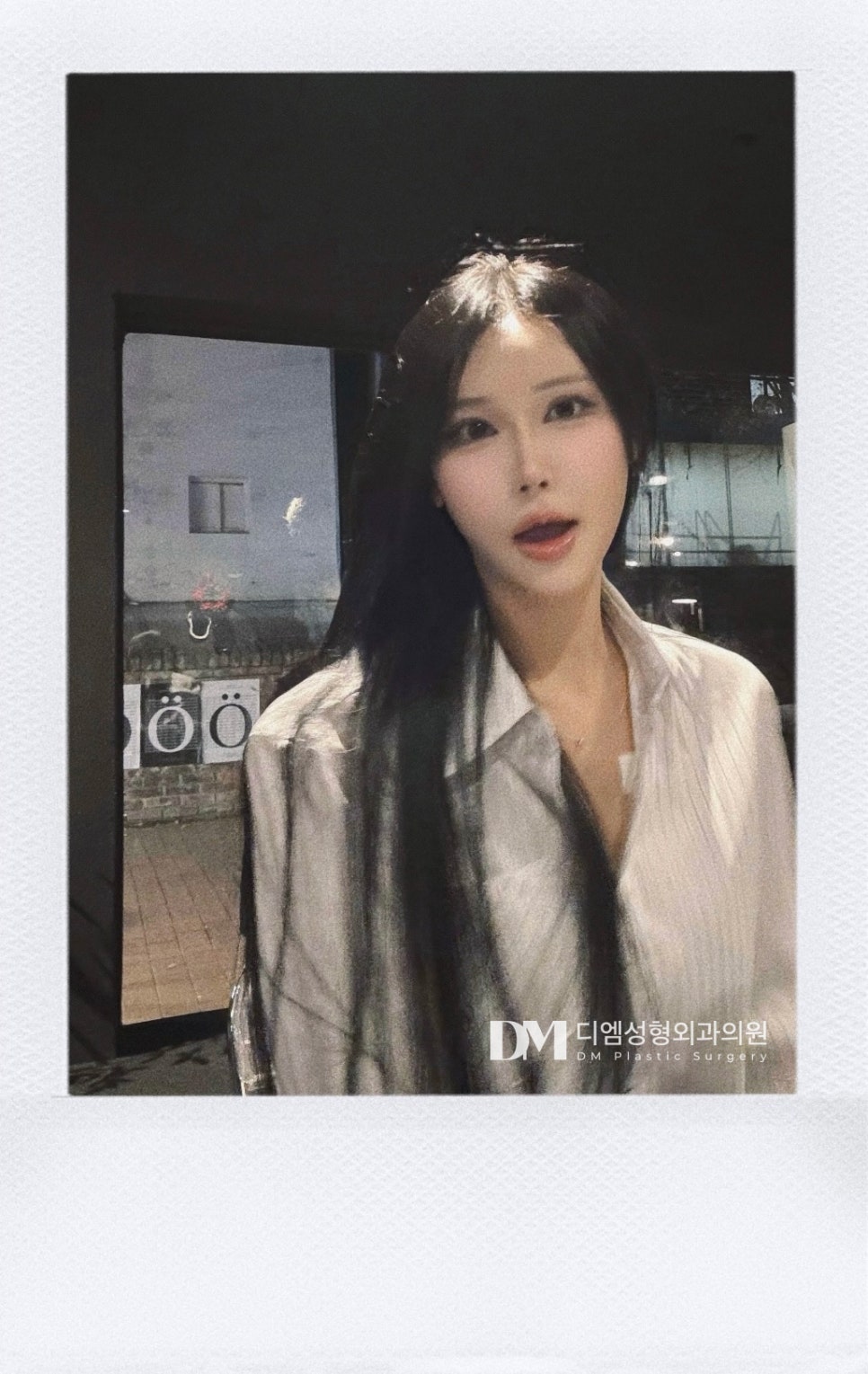 쌍꺼풀수술, 내 눈매에 맞는 자연스러운 라인으로 관련 이미지 15