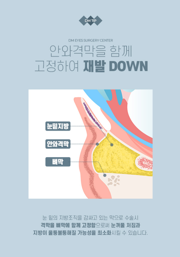 눈 밑 개선으로 환한 동안 인상 되기 관련 이미지 5