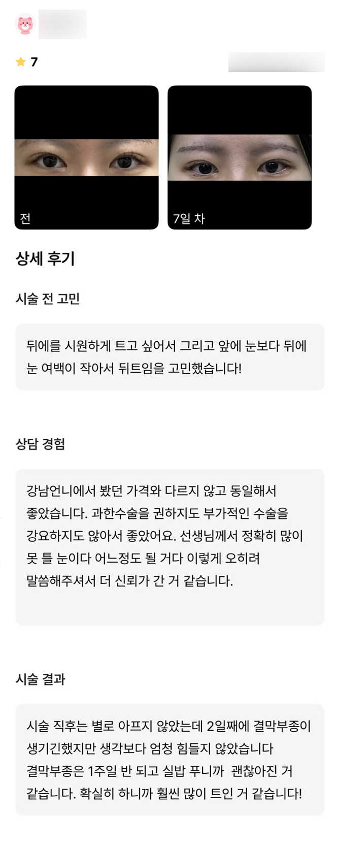 빵트임 후기."확실히 훨씬 많이 트인것 같아요 !" 관련 이미지 1