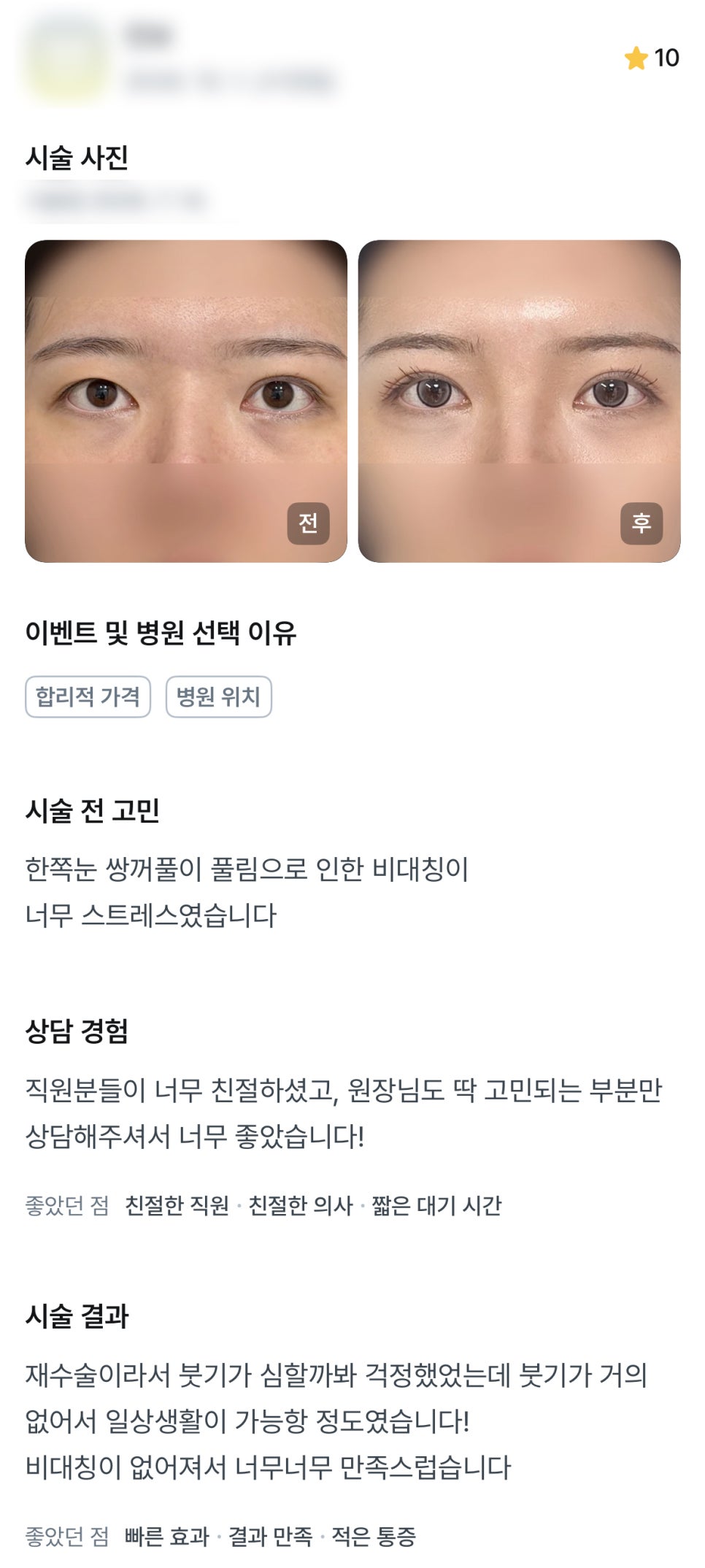 디엠 눈재수술/눈매교정 수술후기, “비대칭이 없어져서 너무너무 만족스러워요!” 관련 이미지 1