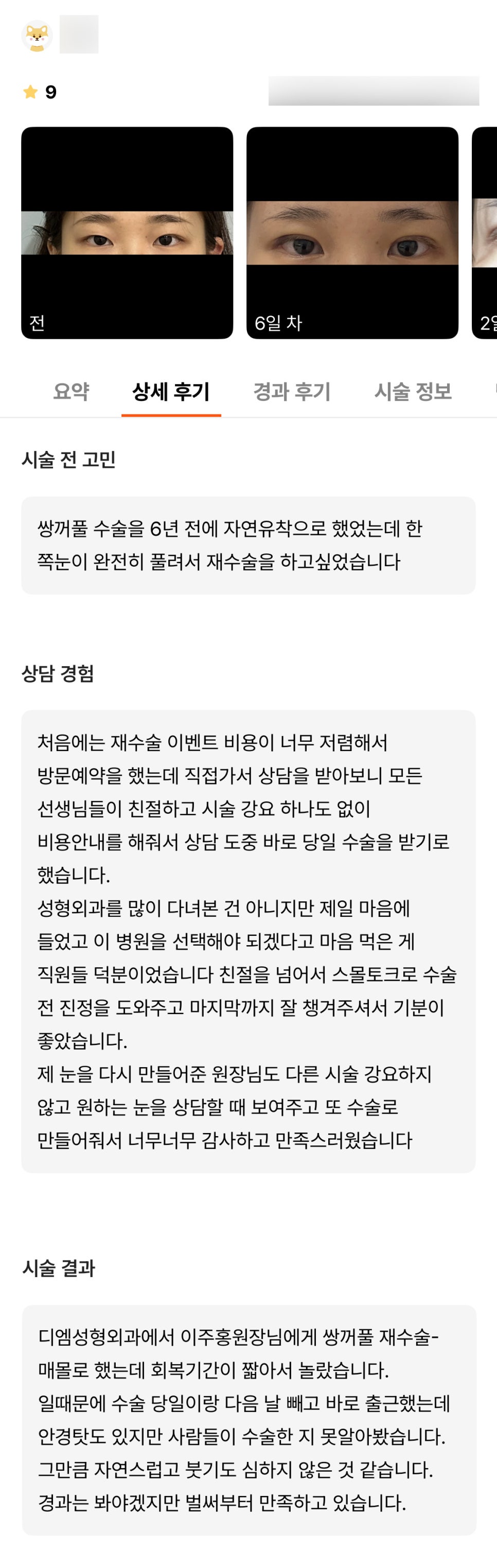 눈재수술 후기."니즈를 맞춰줘서 너무 감사하고 만족스러워요!" 관련 이미지 1