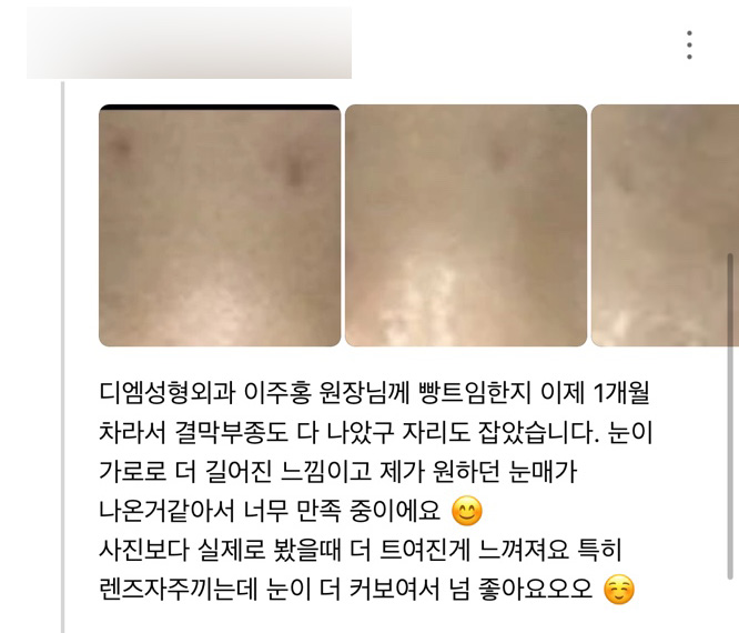 빵트임 후기."제가 원하던 눈매가 나온거 같아서 너무 만족중이에요!" 관련 이미지 1