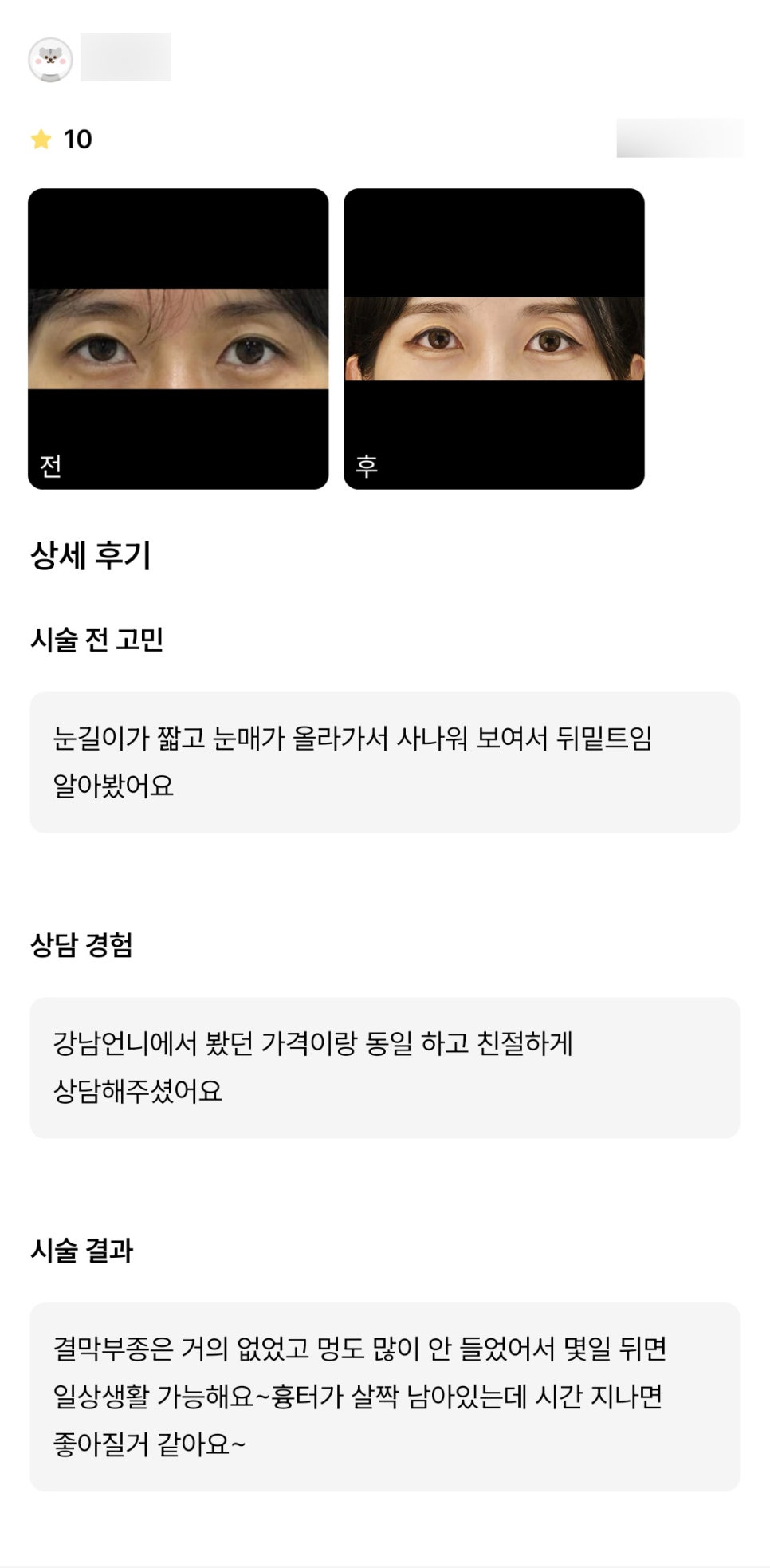뒤밑트임 후기."며칠뒤면 일상생활이 가능해 좋았어요!" 관련 이미지 1