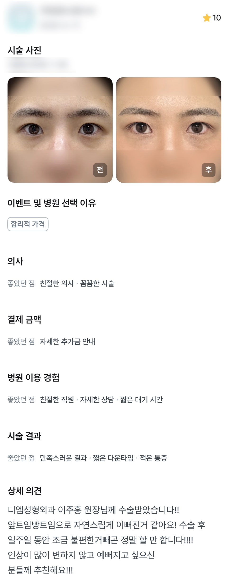 디엠 앞트임/뒤밑트임 수술후기, “자연스럽게 이뻐진 거 같아요!” 관련 이미지 1